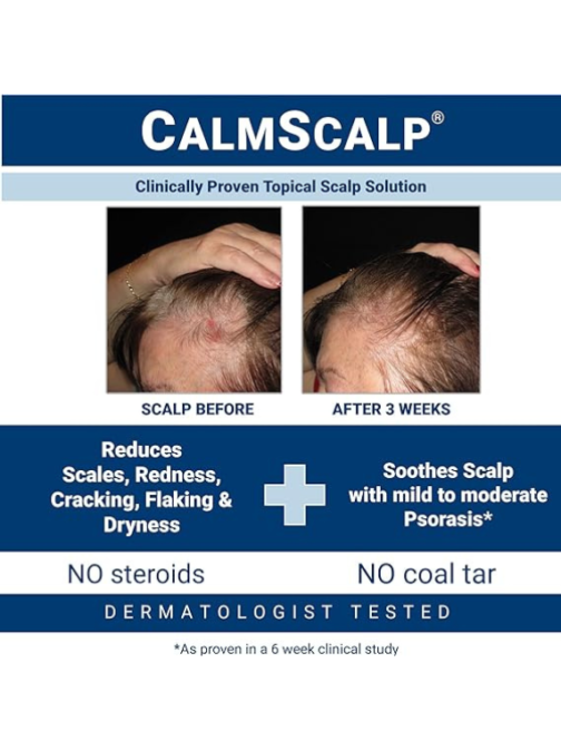 Topical Solution for Symptoms of Mild to Moderate Psoriasis | Irritated Scalp | Hairline Scales | Redness | Dry Scalp | Made in The USA | 4 oz. - Image 2