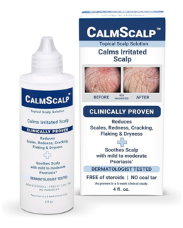 Topical Solution for Symptoms of Mild to Moderate Psoriasis | Irritated Scalp | Hairline Scales | Redness | Dry Scalp | Made in The USA | 4 oz.